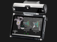 ExactechGPS® Shoulder