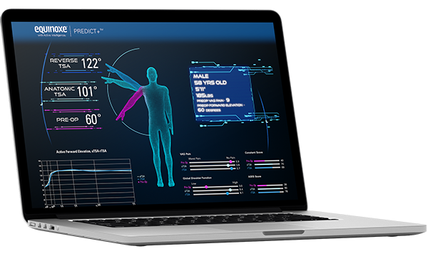 Exactech Shoulder GPS Predict+ - Improved clinical outcomes compared to non-navigated patients